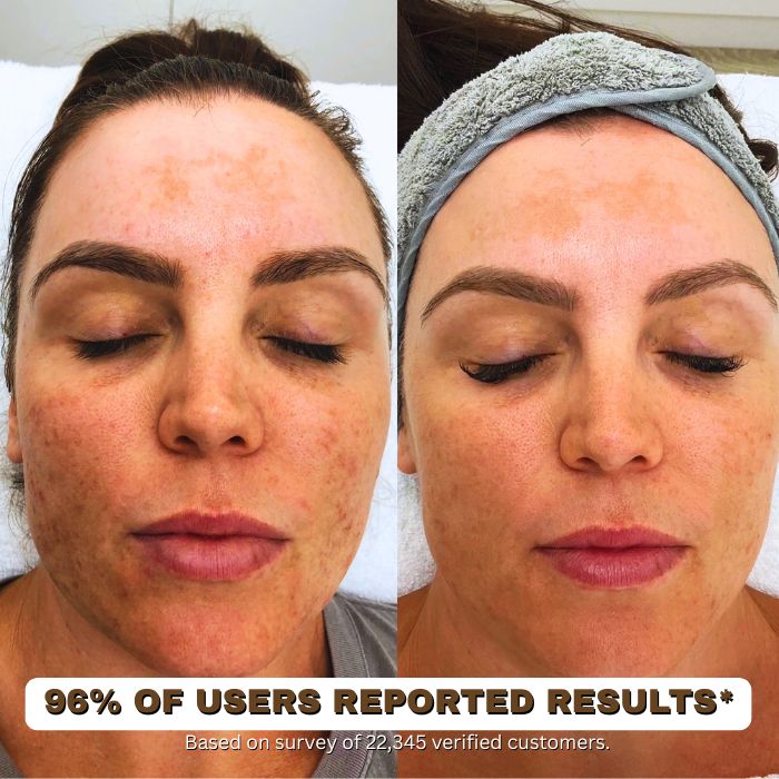 GlowTallow™ Moisturizer